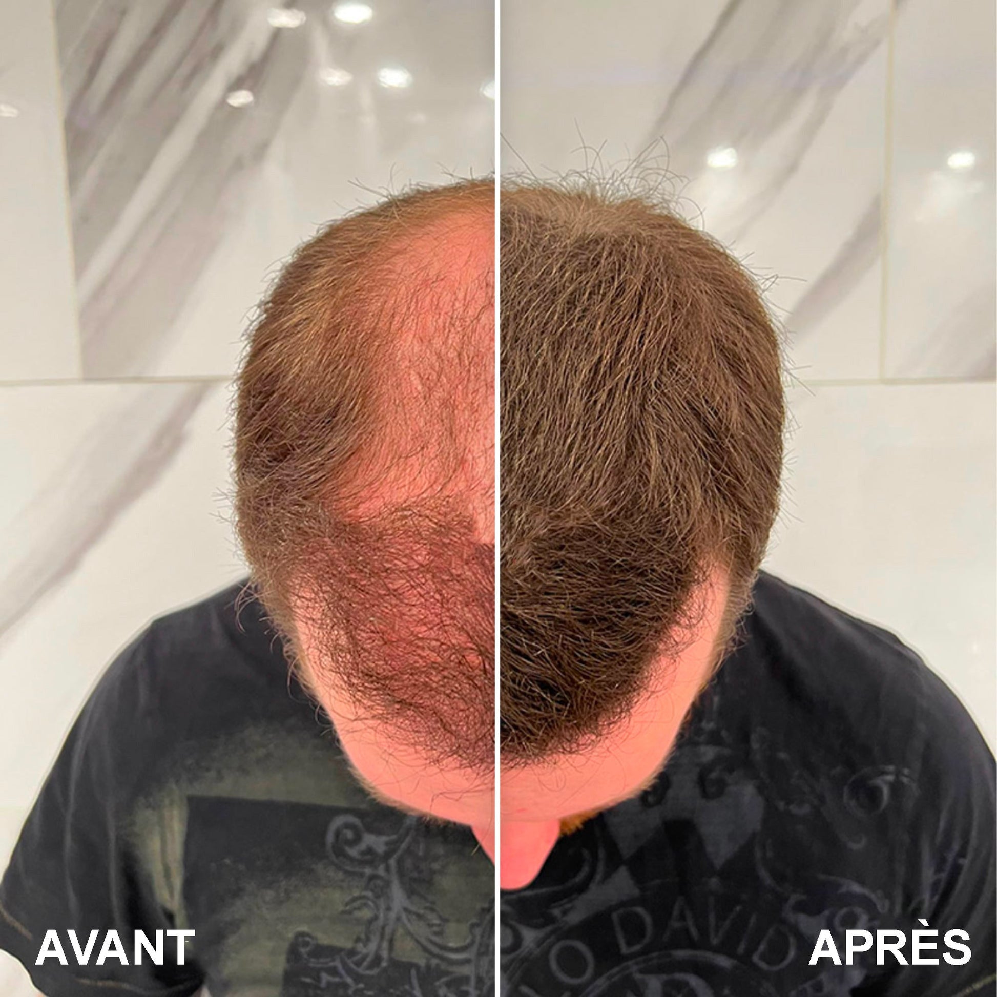 Fibres capillaires - Launchify