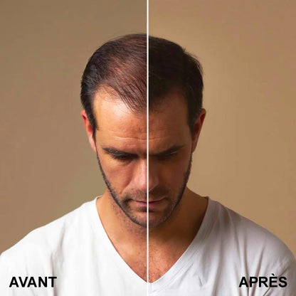 Fibres capillaires - Launchify